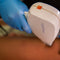 CONSULENZA LASER