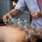 cupping a fuoco - coppettazione - massaggio con coppette - olistico 